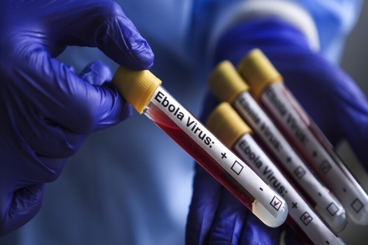 Eboladan ölənlərin sayı 360 nəfərə çatıb - Bu ölkədə