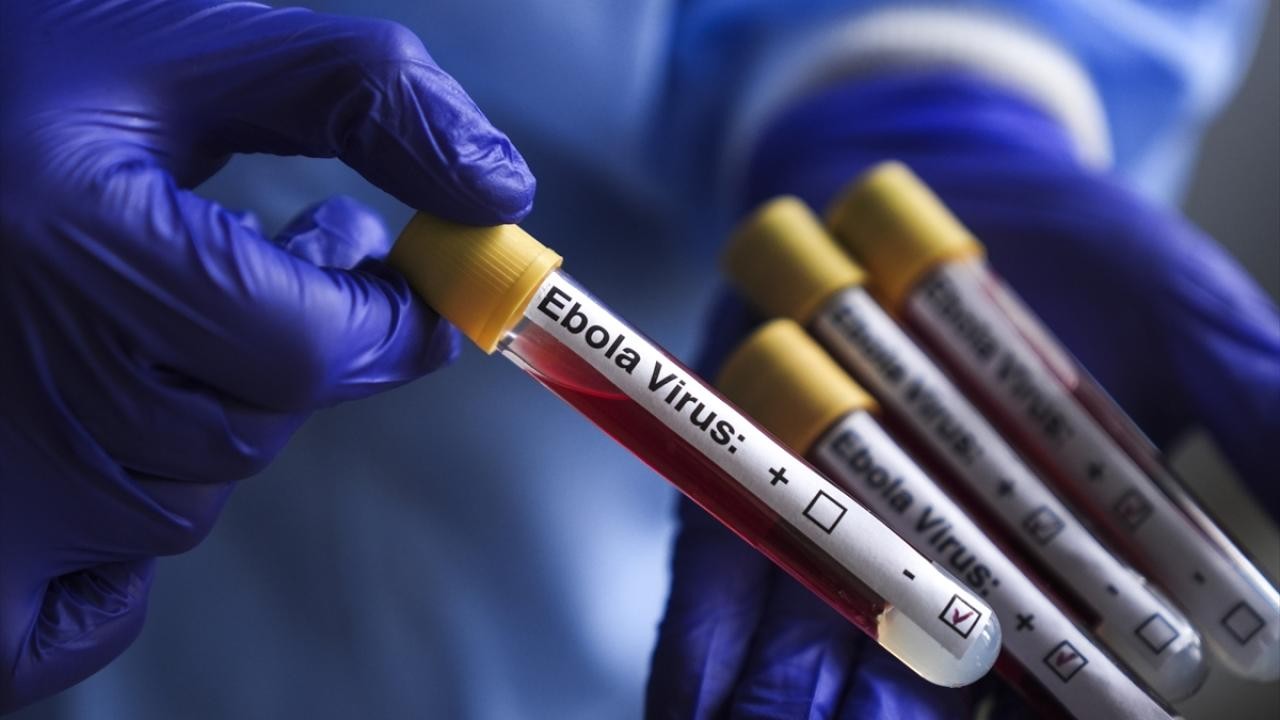 Ebola virusu aşkarlanıb - Bu ölkədə