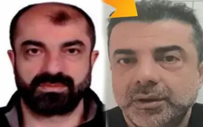 Estetik əməliyyatlarla 7 il gizlənə BİLDİ