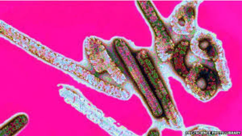 Ebola epidemiyası yayıldı - 65 nəfər öldü